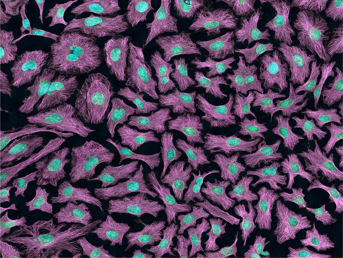 Fluorescence micrograph of individual cells