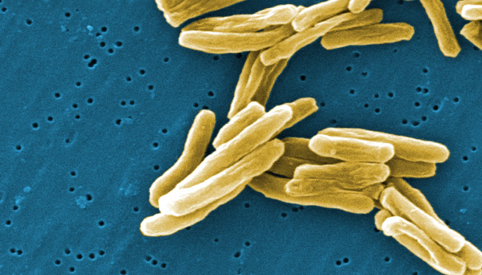 Micrograph of Mycobacterium tuberculosis bacteria